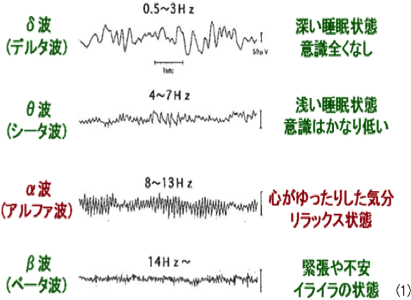 脳波 平坦